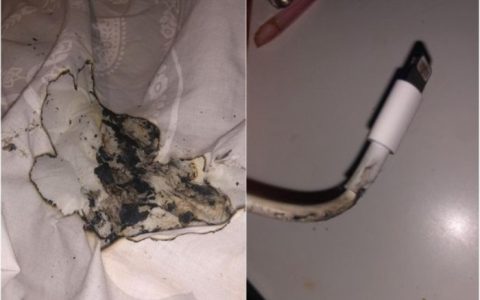 iPhone又出问题了 一位少女因为它面部被烧伤