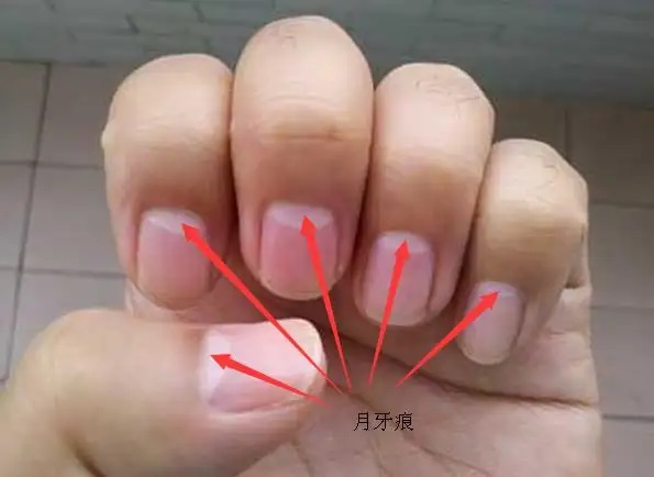 指甲上的月牙是什么 指甲上的月牙和健康有关吗？