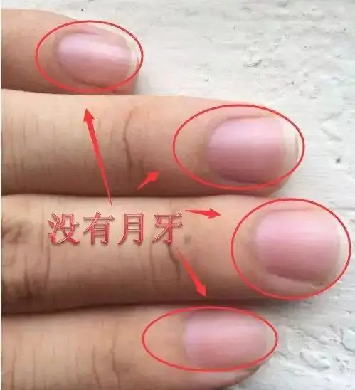 指甲上的月牙是什么 指甲上的月牙和健康有关吗？